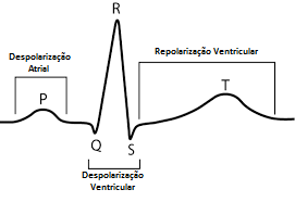 ADRV - Alterações da repolarização ventricular: isso é grave?