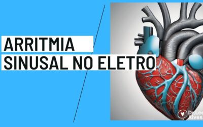 Arritmia sinusal – Guia Completo [2024]