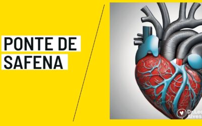 Ponte de Safena: Guia Completo [2024]