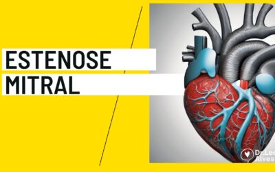 Estenose Mitral: Causas e Tratamento