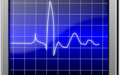 Arritmia cardíaca: Seu Guia Definitivo [2024]