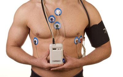 Holter 24 horas: Guia Completo [2024]