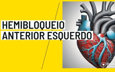 Hemibloqueio Anterior Esquerdo é grave? Como tratar?