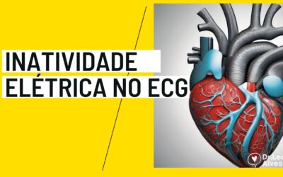 Inatividade elétrica no eletrocardiograma: Tudo sobre!