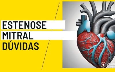 Estenose Mitral: Dúvidas respondidas