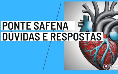 Ponte de Safena – 14 Dúvidas respondidas