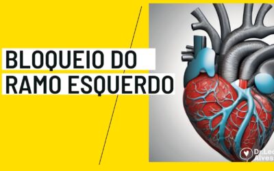 Bloqueio do Ramo Esquerdo, BRE: Guia Definitivo [2024]